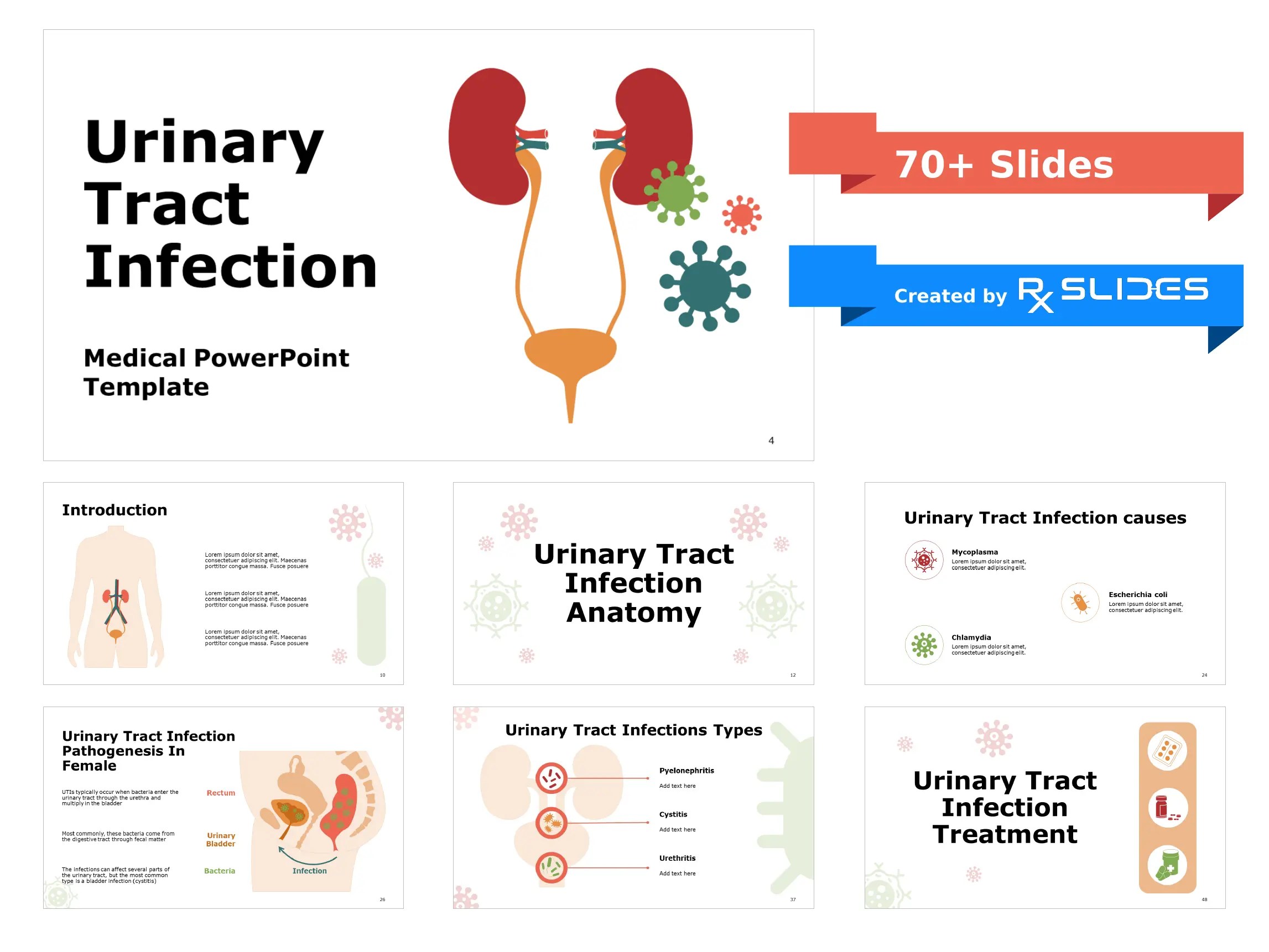 Urinary Tract Infections PowerPoint Template RxSlides The largest